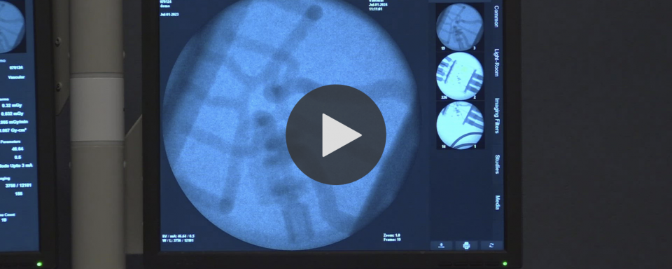 Snapshot of Bioengineering Devices Laboratory video on stroke recovery rates. 